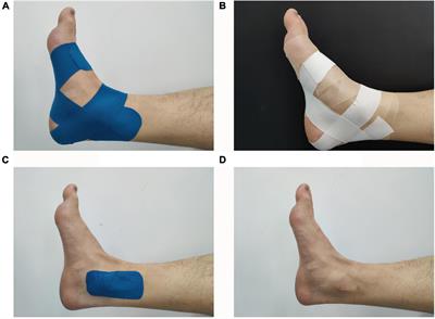 Effect of Kinesiology Tape on Muscle Activation of Lower Extremity and Ankle Kinesthesia in Individuals With Unilateral Chronic Ankle Instability